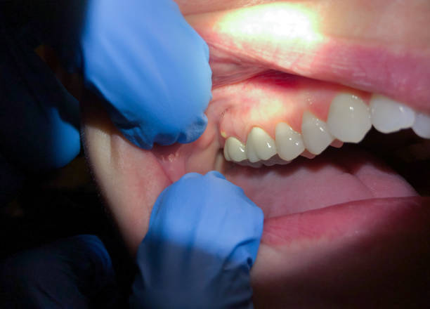 Best After-Hours Dental Trauma Care in Fayetteville, AL